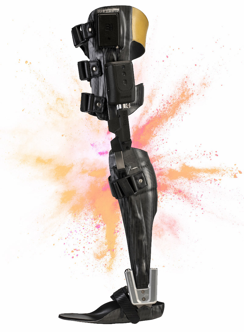 C-Brace Orthosis, Tectus Orthosis, Clark & Associates