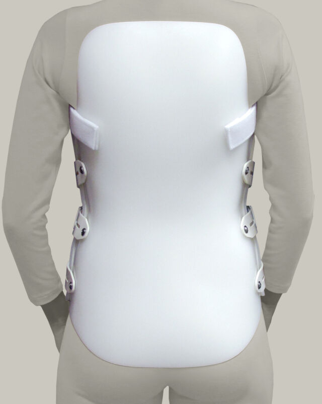 Thoracolumbosacral Orthosis, TSLO Back Brace, Clark & Associates