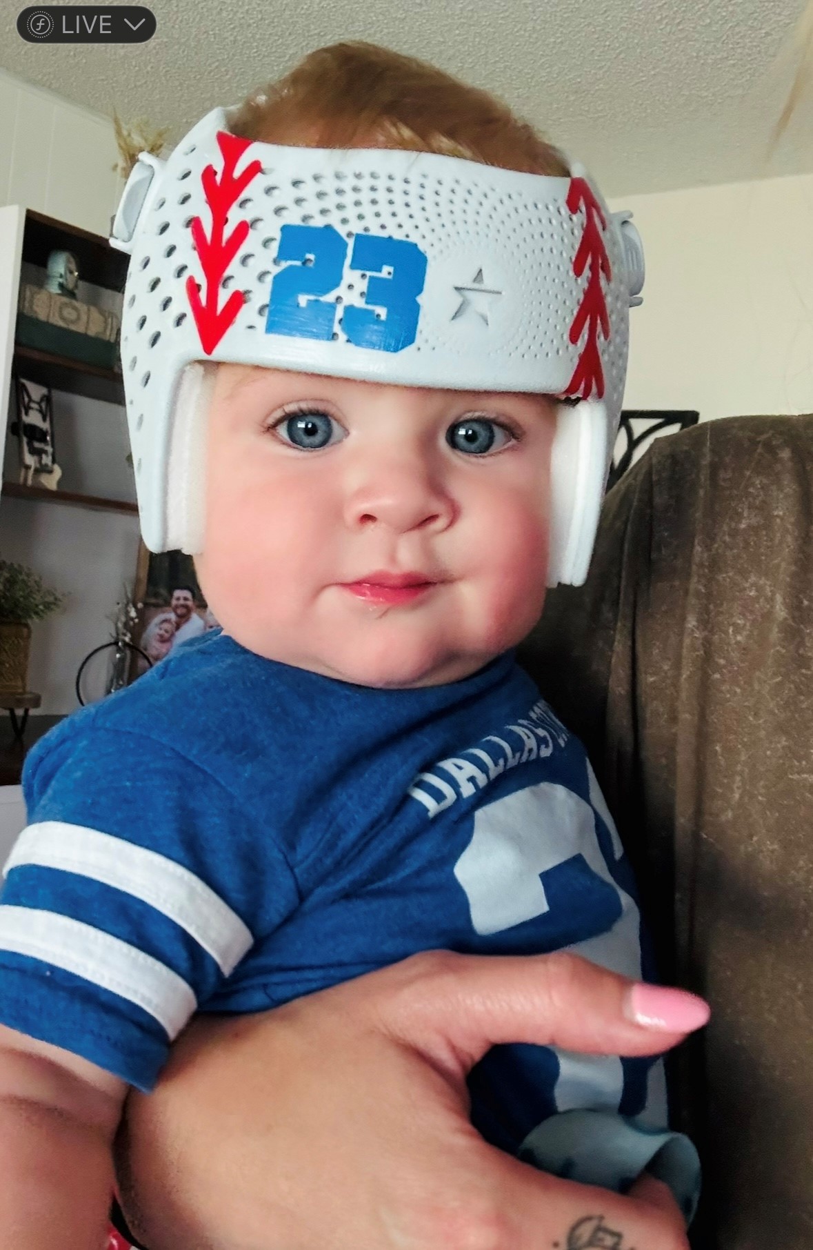 Cranial Helmets Iowa, Kids Cranial Helmet, Head Prosthesis Iowa, Iowa Cranial Prosthetics, Kids Head Helmet